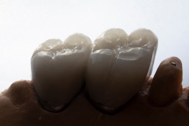 implant supported dentures