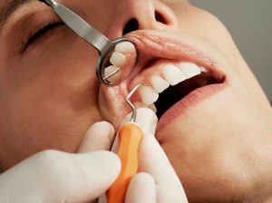 dental exam cleaning in lansing mi