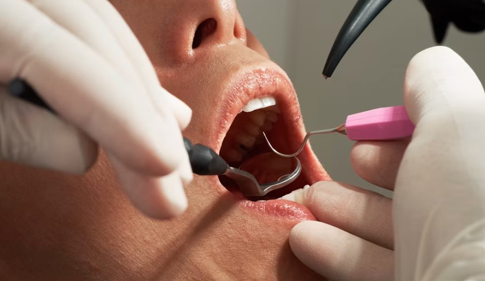 teeth cleaning in lansing